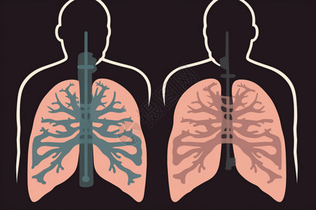 人体肺部图标插画