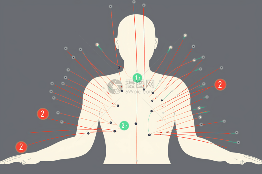 针灸治疗的平面插图图片