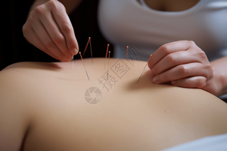 胸部穴位针灸在疼痛管理中的使用设计图片