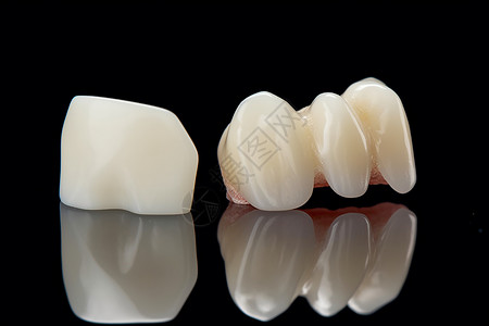 牙冠修复制作假牙模型背景