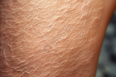 人腿上的干性皮肤特征高清图片