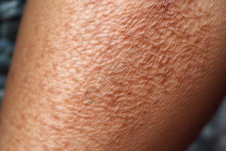 干性皮肤中性皮肤一个人的腿上皮肤像鳞片状设计图片