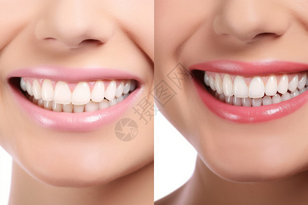牙齿对比洗漱前后对比背景