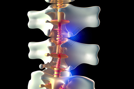椎间盘的3D模型图片