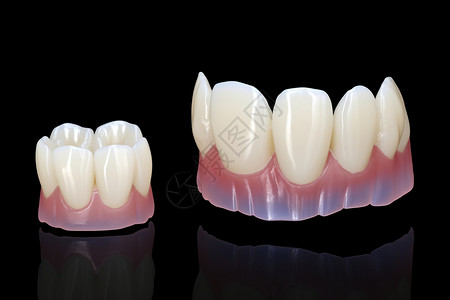 用于研究的牙齿模型高清图片