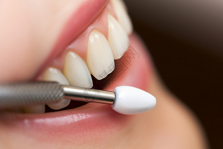 智能牙齿修复修复美白牙齿背景