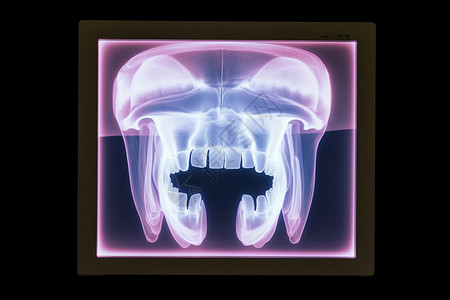 口腔x射线牙齿x射线高清图片