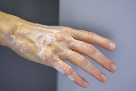 手部疾病治疗背景图片