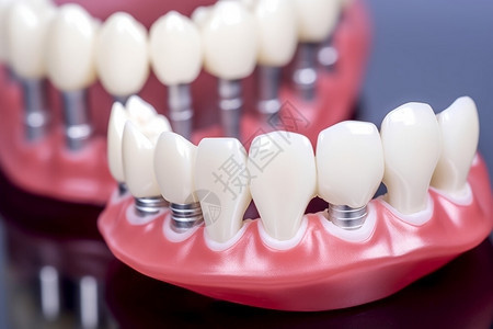 健康护理口腔的人造牙齿模型图片