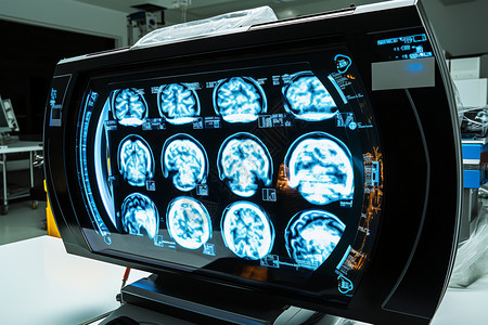 大脑ct医院的ct扫描背景