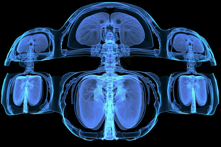 揪片子腹部MRI扫描设计图片