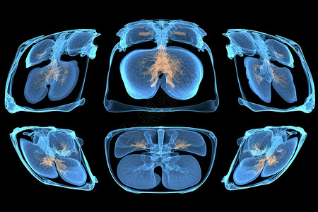 揪片子ct扫描的片子设计图片