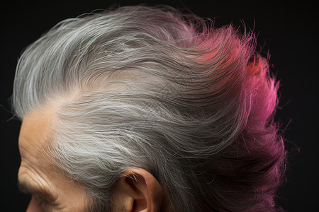 毛囊检测老年男子的白发背景