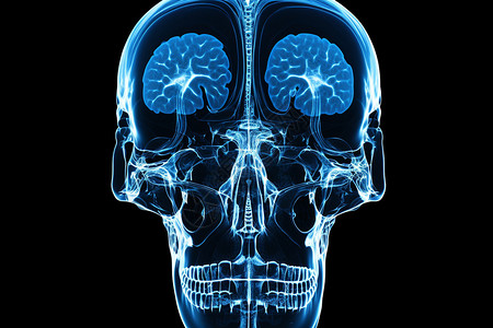 脑部CT背景图片