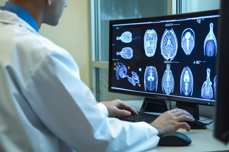 人体器官大脑电脑前的医生背景