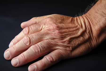 老人的手皮肤症状高清图片