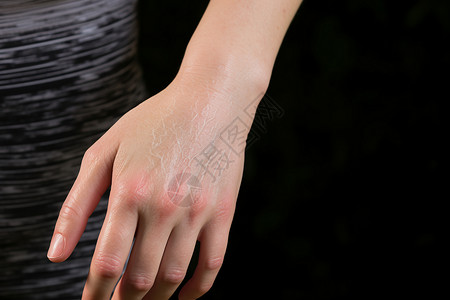 女人疼痛的手背景图片