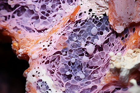 生物组织肝纤维化高清图片